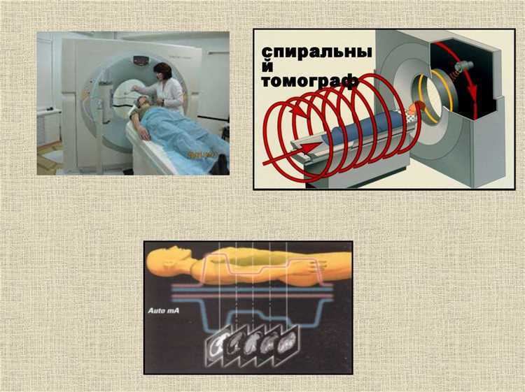 Методы введения ЭВН и контроль дозировки